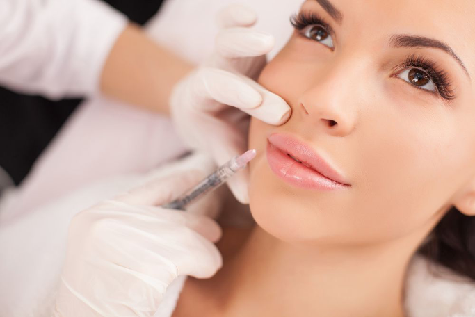 Nasolabial and marionette line treatment